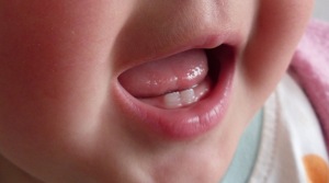 baby-teeth-care-tips